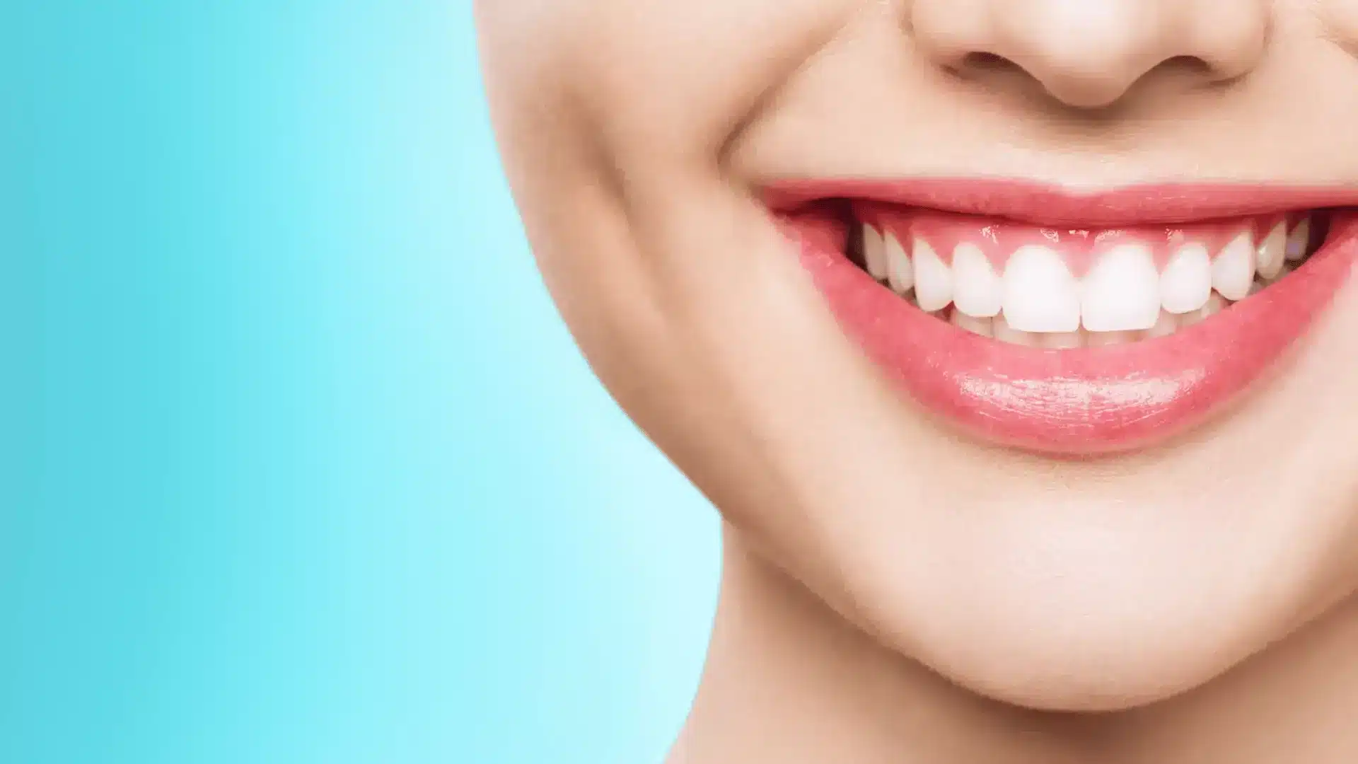 Close-up of a person smiling with bright white teeth after a teeth whitening treatment.
